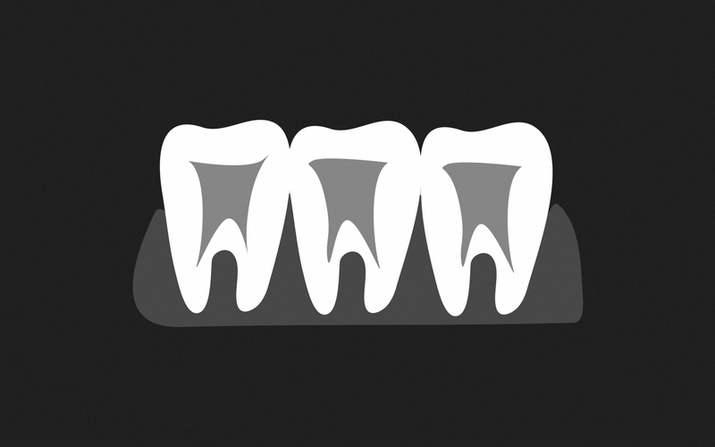 All About Dental X-Rays